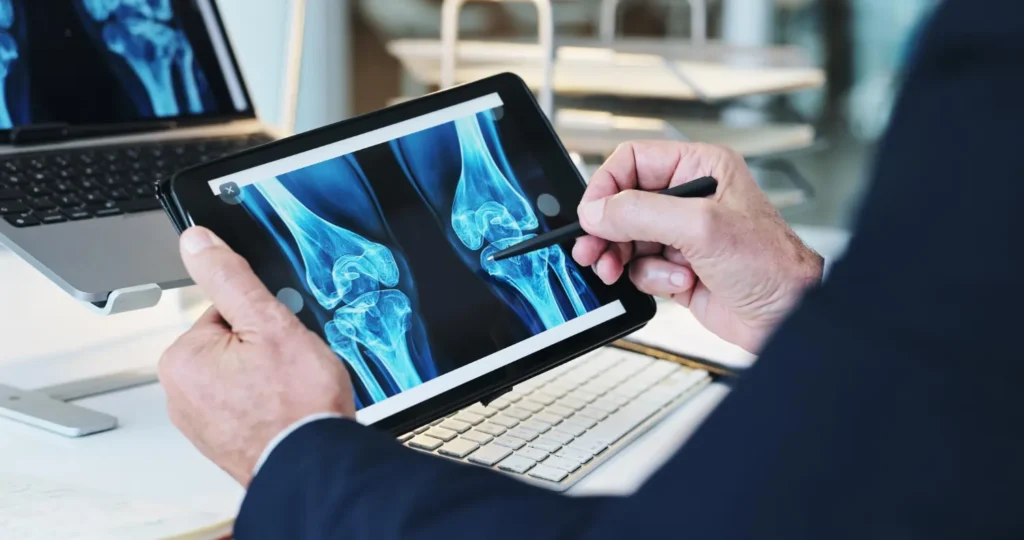Getting a Radiation-Free Home Bone Scan in Los Angeles Home bone scan in Los Angeles