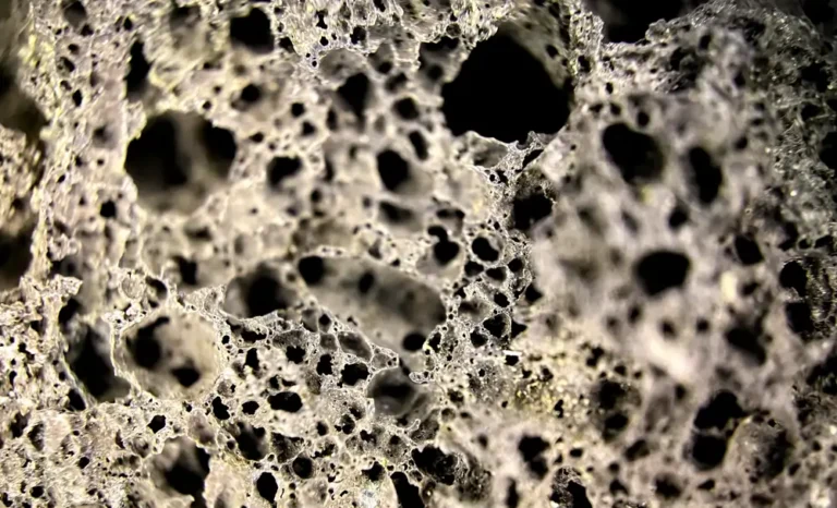 Articles Know these Signs You Need a Bone Density Test