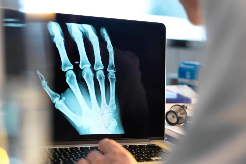 REMS vs DEXA Scan: 7 Reasons Radiation-Free Testing in Los Angeles Is Winning REMS vs DEXA Scan: 7 Reasons Radiation-Free Testing in Los Angeles Is Winning REMS vs DEXA scan
