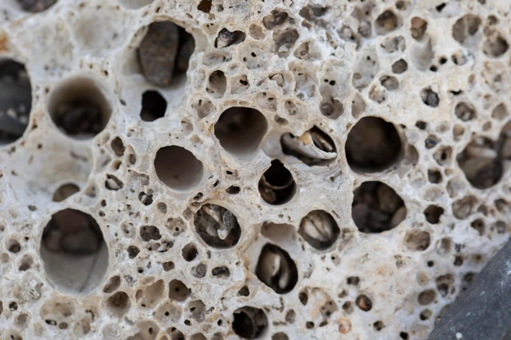 Osteopenia vs. Osteoporosis: What's the Difference and Why It Matters Osteopenia vs. Osteoporosis: What's the Difference and Why It Matters Osteopenia vs. Osteoporosis