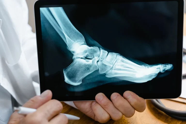 Articles Bone health assessment check with a radiation-free REMS scan in Los Angeles