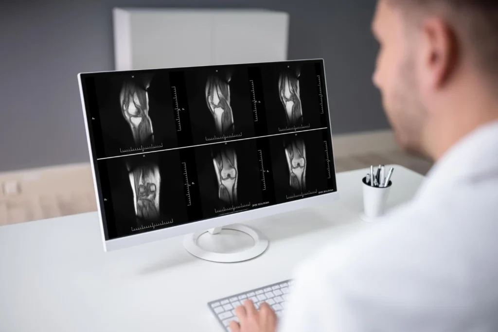 Echolight Scan in California: Mobile, Radiation-Free REMS Bone Density Testing Echolight Scan in California: Mobile, Radiation-Free REMS Bone Density Testing Echolight scan in California