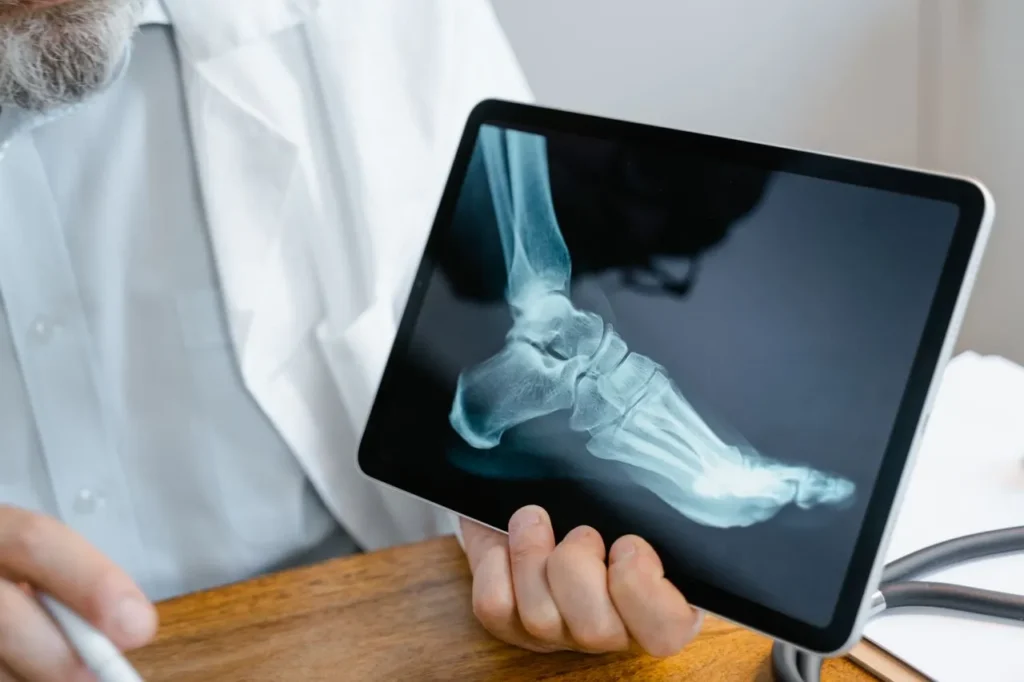 How REMS Imaging Works: The Technology Behind a Safer Bone Scan How REMS Imaging Works: The Technology Behind a Safer Bone Scan REMS imaging