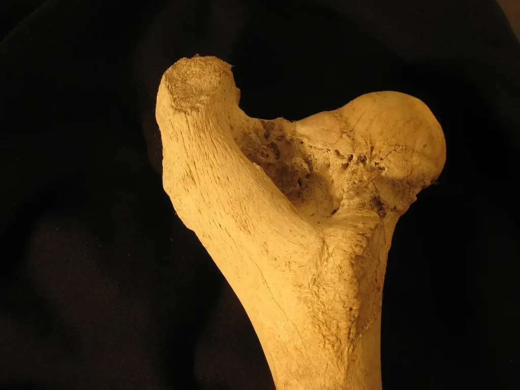 Bone Density Score Explained: Everything You Should Know Bone Density Score Explained: Everything You Should Know bone density score