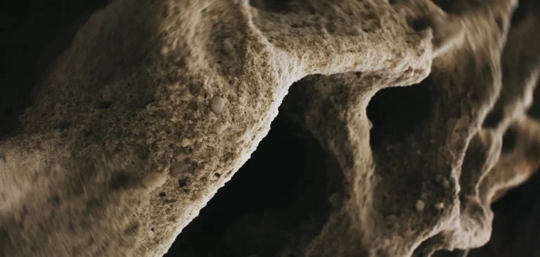 Articles A bone density score, more formally called a T-score, measures how much calcium and mineral content is packed into a specific section of your bone
