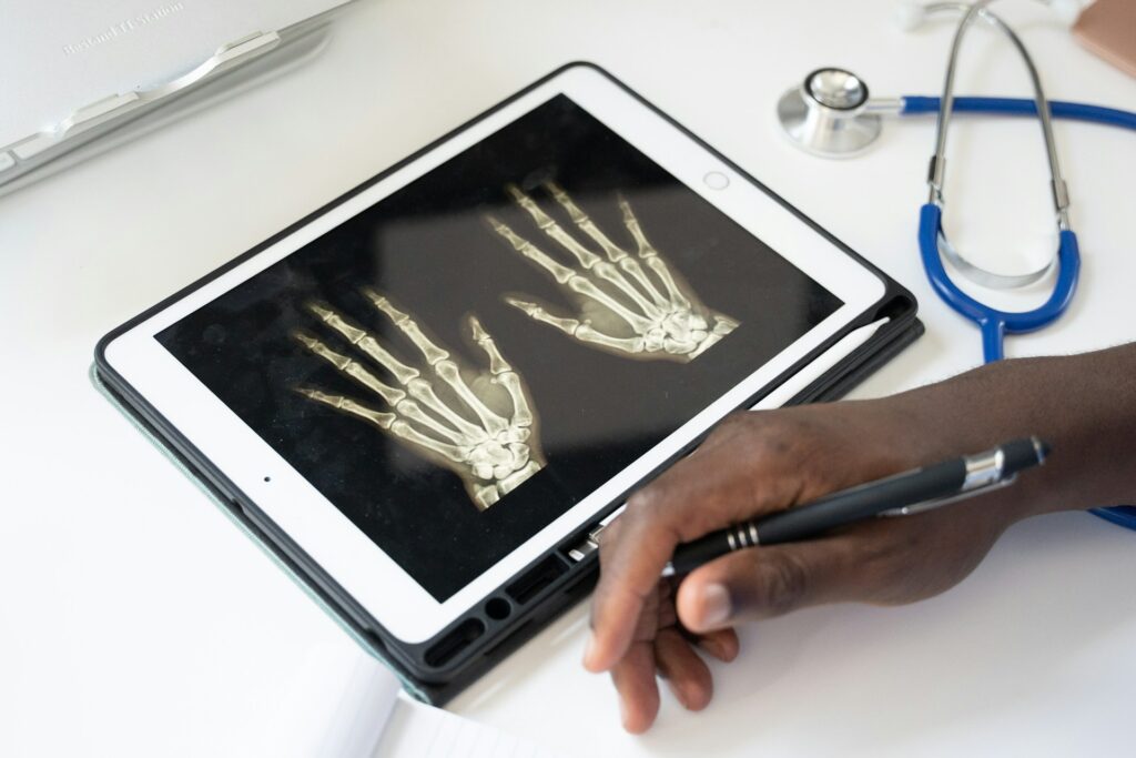 Reduce Fracture Risk: What a Radiation-Free Bone Scan Can Tell You Reduce Fracture Risk: What a Radiation-Free Bone Scan Can Tell You Reduce fracture risk