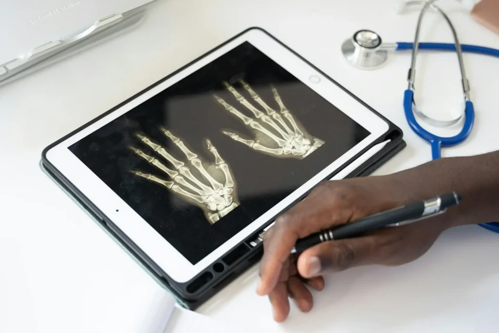 Bone Density Score Explained: Everything You Should Know Bone Density Score Explained: Everything You Should Know bone density score