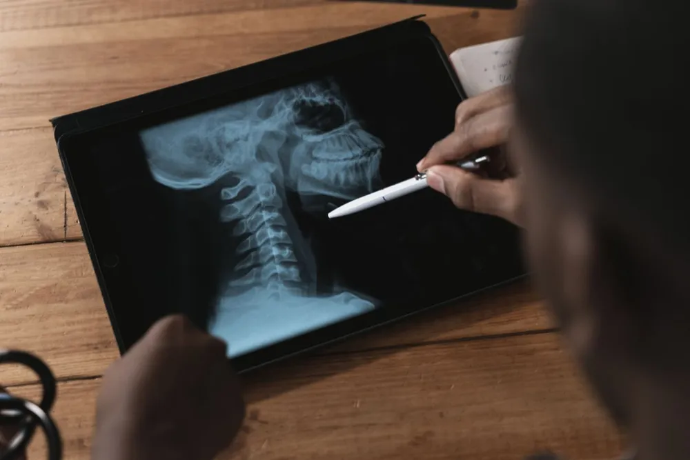Osteoporosis and Genetics: 7 Alarming Truths Your REMS Bone Density Scan Can Reveal Osteoporosis and Genetics: 7 Alarming Truths Your REMS Bone Density Scan Can Reveal Osteoporosis and genetics